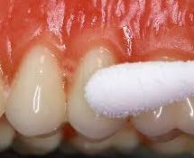 Dental Emergency Services